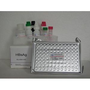 Buy cheap ELISA detection reagent kit High Accuracy HBsAg Elisa Test Kit from wholesalers