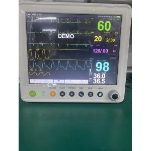 Buy cheap Portable Patient Monitor With Parameters Of ETCO2 ECG NIBP SPO2 RESP TEMP PR from wholesalers