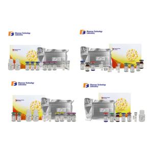 Buy cheap NMDAR1 Human Sandwich Immunosorbent Assay Kit With Strong Sensitivity from wholesalers