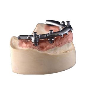 Buy cheap High-Density PFM Dental Implants Dentures Strong Hardness Long Lasting​ product