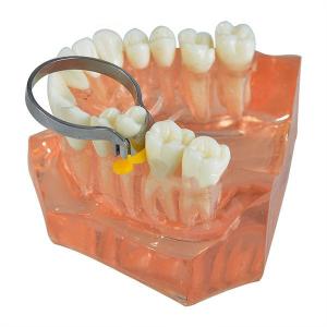 Buy cheap Stainless Steel Dental Dental Sectional Contoured Matrices Assorted Kit from wholesalers