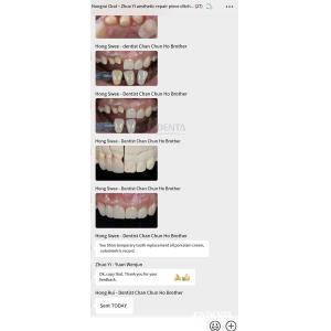 Buy cheap Painless Procedure BOPT Dental Technique for Accurate Tooth Preparation from wholesalers