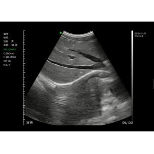 Wireless Ultrasound Probe Handheld Ultrasound Device With Scanning Depth 40