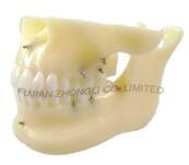 China Dental Oral dentistry practice model teaching training material imitation bone simulation oral model on sale
