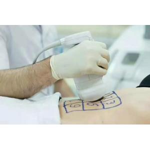 576 dots Slimming Machine Weight Loss Body Anti Cellulite Liposonixing Lipo