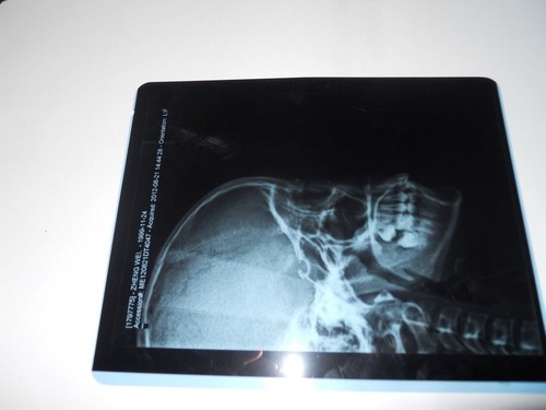 Quality KND-A Environment friendly Medical Dry Imaging Film For X Ray Examination On AGFA 5300 for sale