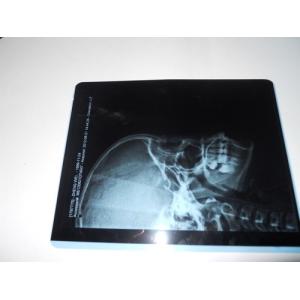 Buy cheap KND-A Environment friendly Medical Dry Imaging Film For X Ray Examination On AGFA 5300 from wholesalers