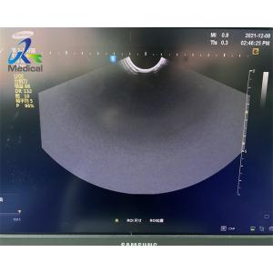 Buy cheap Samsung EVN4-9 Ultrasound Probe Repair Imaging With Dark Shadows from wholesalers