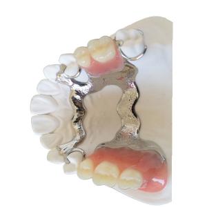 Buy cheap FDA PFM Dental Bridge Good Biocompatibility 3D Printing Dental Models from wholesalers