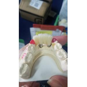 Buy cheap Smooth Surface Biocompatible Zirconia Tooth Crown Easy Maintain from wholesalers