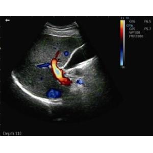 Buy cheap Hand Held Ultrasound Devices Portable Ultrasound Scanner Color Doppler With 16G Capacity from wholesalers