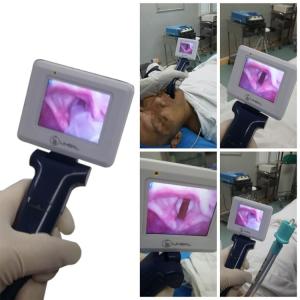 Buy cheap Operating Portable Video Laryngoscope Using In Routine Endotracheal Intubation from wholesalers