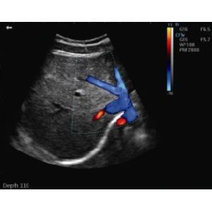 Buy cheap Portable Pregnancy Ultrasound Scanner with Abdominal Convex Transvaginal Transducers from wholesalers