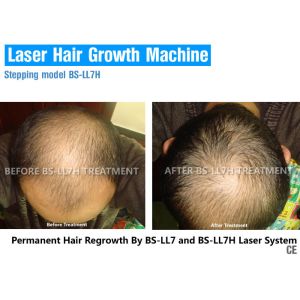 Buy cheap Low Level Laser Therapy For Hair Growth from wholesalers