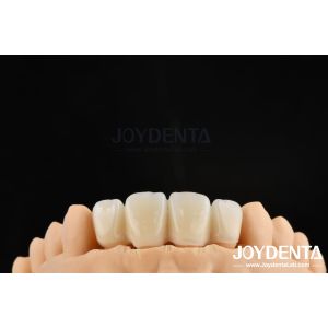 Buy cheap Biologically Oriented Preparation Technique BOPT For Accurate Dental Preparation product