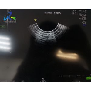 Buy cheap GE RIC5-9A-RS Ultrasound Transducer Crystal Array And Dome Replacement 4D And Circuit Repairing from wholesalers