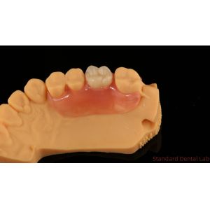 Buy cheap Dental TCS Valplast Flexible Partial Dentures Nesbit Valplast Finish China product