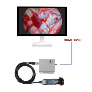 Buy cheap Factory Wholesale 1080P Portable Endoscope Camera For Vet ENT Diagnose Use from wholesalers