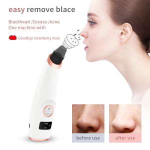 Buy cheap Suction Pore Cleaner Blackhead Extraction Machine Portable Electronic Multi Function from wholesalers