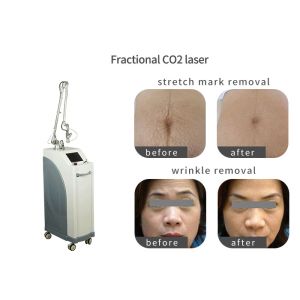 Buy cheap Pixel CO2 Vaginal Rejuvenation Machine , Laser Skin Treatment Equipment from wholesalers