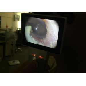 Micro SD Card USB Ear Camera Digital Video Otoscope General Imaging And