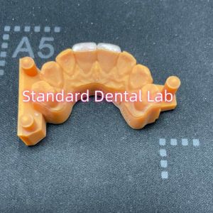 Buy cheap High Colour Stability Ivoclar Emax Laminate Veneers High Translucency from wholesalers