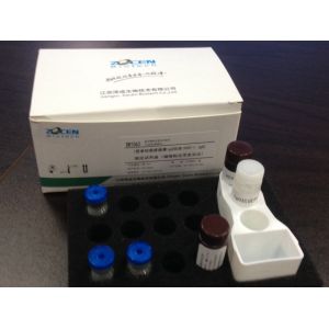 Buy cheap 50/100 Test Kit(Angiotensin II- human) for Automatic immunoassay analyzer in Hypertension from wholesalers