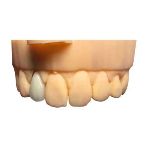 Buy cheap Chromecast Safety PFM Dental Crown Bridge Good Biocompatibility from wholesalers