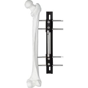 Buy cheap Pediatric LRS system orthofix Limb Lengthening External Fixator from wholesalers