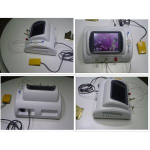 2015 most advanced and effective vascular removal machine