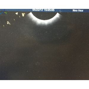 Buy cheap GE 8C-RS Micro Convex Ultrasound Transducer Probe Medical Devices Small Parts from wholesalers