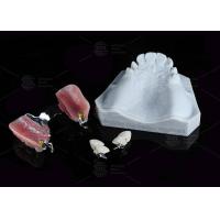 Buy cheap Dental Prostheses Key Way Attachment Precision Attachment Adjustable Retentive product