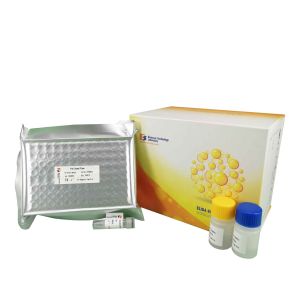 Buy cheap 96 Wells Customized Mouse High Sensitive Immunoglobulin Sandwich ELISA Kit from wholesalers