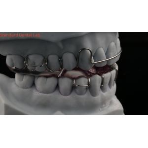 Teeth Expansion And Distalization Adjusting Expander In Mouth Orthodontist