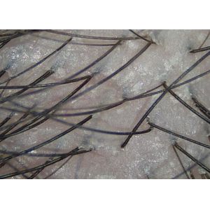 Handhled Digital Skin Moisture And Oil Analyzer With Professional Software