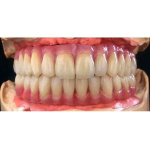 Buy cheap Zirconia All-Ceramic Teeth Crowns & Bridges from wholesalers