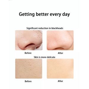 Buy cheap Ultrasonic Cleaning Lifting Skin care Machine Spatula Positive Negative Ions Export EMS Skin Scrubber from wholesalers