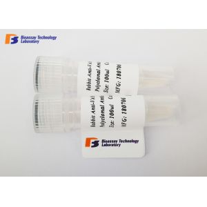 Buy cheap Neuron Specific Enolase Mouse Monoclonal Antibodies CE / ISO / MSDS Approved from wholesalers