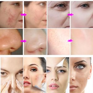 Buy cheap Professional CO2 Oxygen Facial Machine for Home Use with 2 Years Warranty and OEM/ODM Service from wholesalers