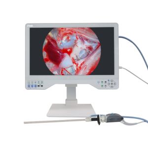 China Medical 24 FHD Laparoscopic Imaging System 80Watts LED Cold Light Source & Endoscope Camera on sale