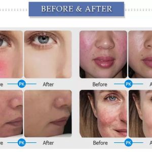 Buy cheap Professional 980nm Diode Laser Machine For Spider Veins / Vascular Removal from wholesalers