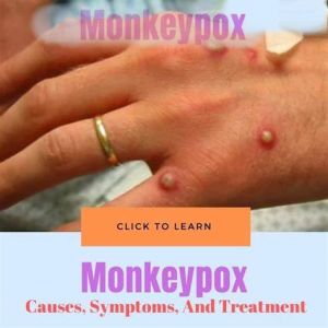 Buy cheap Rapid Detection Test Monkeypox Virus Test Kit Pcr Flocked Swab Monkeypox Virus Rapid Antigen Test Kits from wholesalers