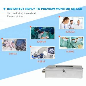 Ultrasound Medical Video Recorder with Electric Power Source for Record