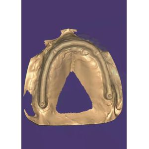 Buy cheap 3D model Zirconia crown from wholesalers