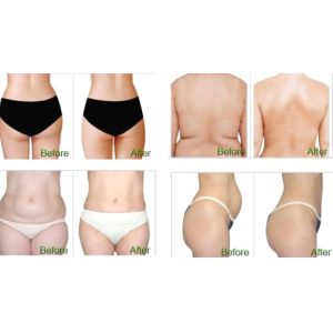 Buy cheap Super Cool System Fat Reduction Cryolipolysis Cool Body Sculpting Machine from wholesalers