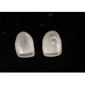 Buy cheap Aesthetic Restoration Emax Ceramic Veneers Translucency with Polished Surface from wholesalers