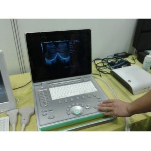 Popular 3D Digital Laptop Veterinary Ultrasound Scanner Lightweight Easy To