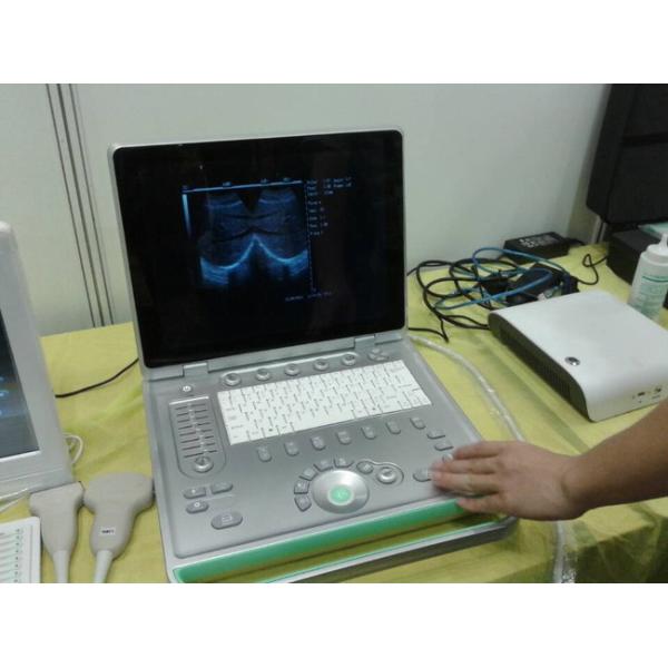 Popular 3D Digital Laptop Veterinary Ultrasound Scanner Lightweight Easy To