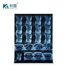 China Inkjet Medical X-RAY Blue Film 210micron CT DR Film A4 8x10 Sheet Or Roll For Medical Inkjet Printing Media on sale