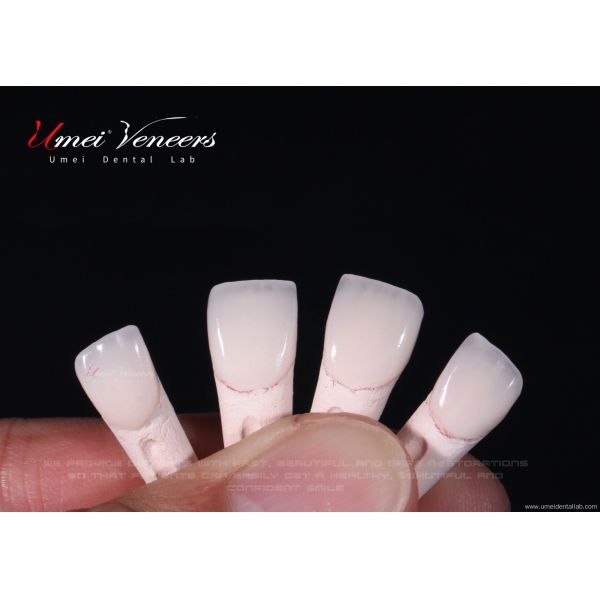 Quality Ultra thin cast porcelain veneer for sale